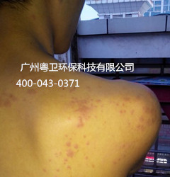 廣州專業(yè)滅臭蟲公司 廣州專業(yè)滅臭蟲公司